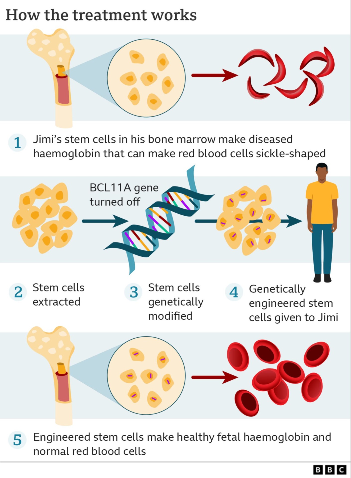 graphic showing the stem cell modification process