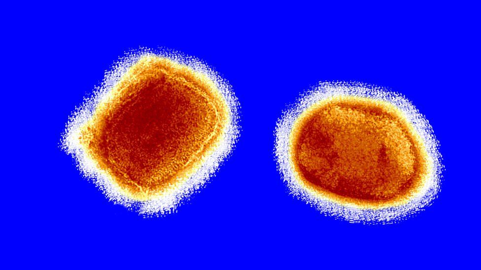 Monkeypox virus seen under an electron microscope