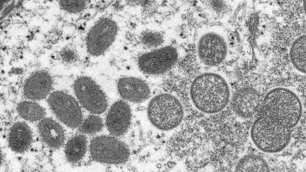 Monkeypox under a microscope