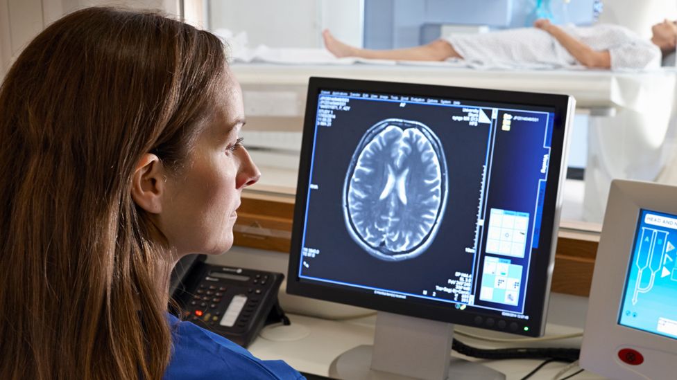 Stock photo of a radiologist looking at a brain scan image on a computer screen