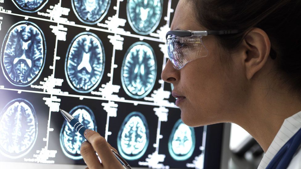 Doctor looks at brain scans