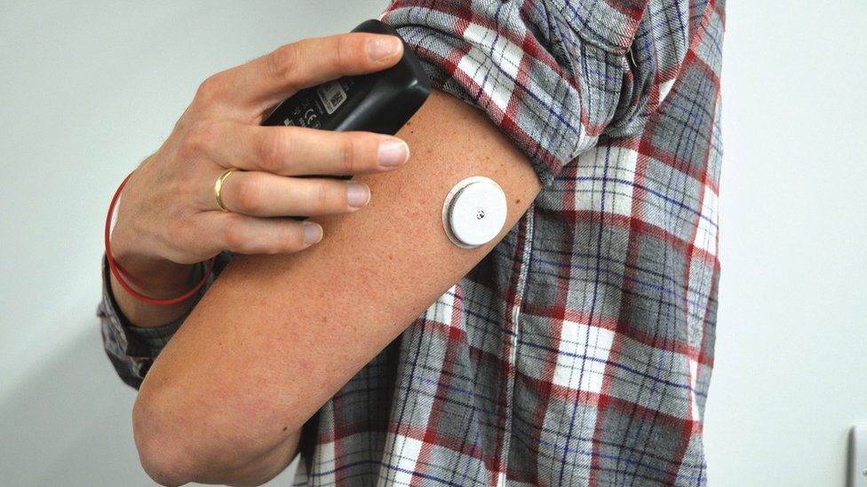 A person wearing a flash glucose monitor