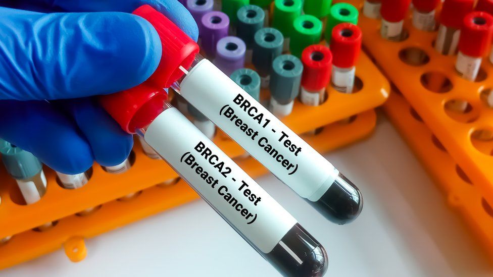 BRCA tests
